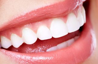 5 Ei-invasiivista Kotihoitoa Super Valkoisille Hampaillesi